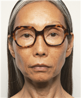 Montatura vista Kaleos Donna AGNES 49 C002 - AGNES 49 C002